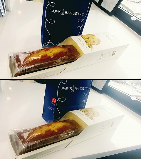 여드름 흉터 치료하시는 고객님^^ 