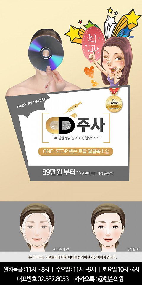 얼굴축소주사 술 핸슨 씨디주사(상표특허출원중) 이벤트 핸슨의원 