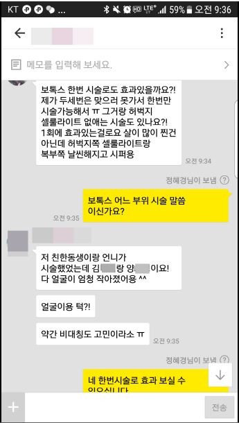 보톡스 후기입니다^^ 