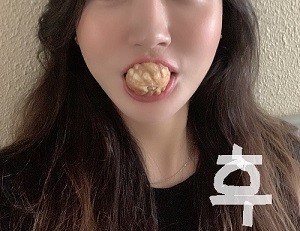 셀피주사 후기입니다. 
