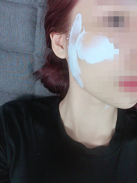 셀피 주사 광대 효과 대박!! 