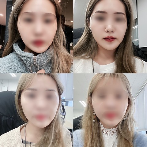광대축소에는 여윽시 핸슨! 