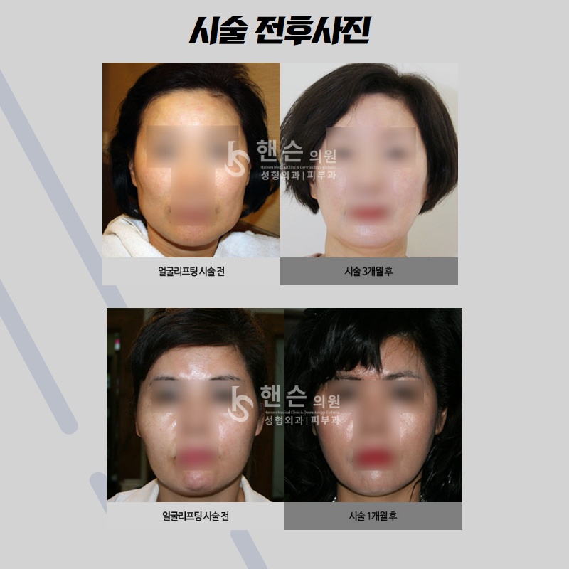 1757f7a37b813a4ace17027605b70a45_1586167