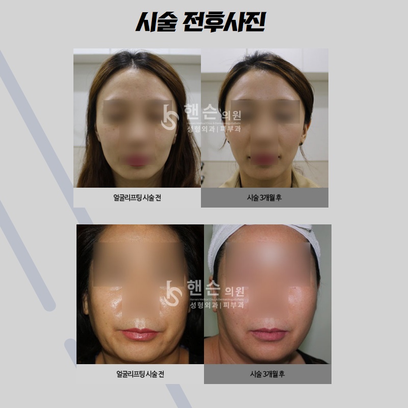 1757f7a37b813a4ace17027605b70a45_1586167