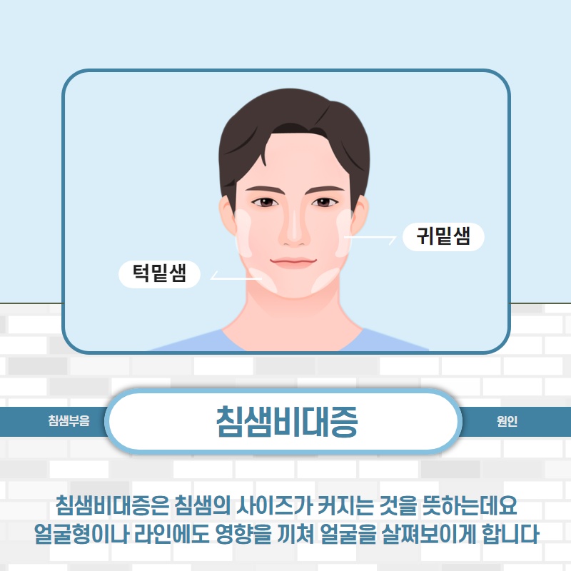 988a3d24be07614d4b05a8d9e7fa9784_1585906