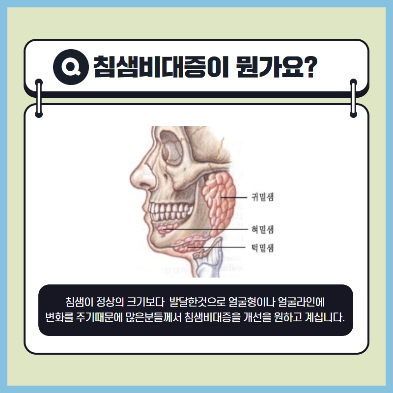 e551c14edbd17add80ebb604ab396547_1596537