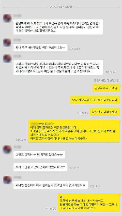 옆광대보톡스(얼굴폭축소주사) 광대축소 효과시기, 볼패임, 볼처짐 등 후기 