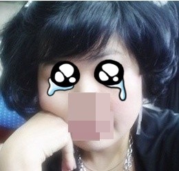 광대보톡스 후 얼굴불편한 시간을 보내고 나면 