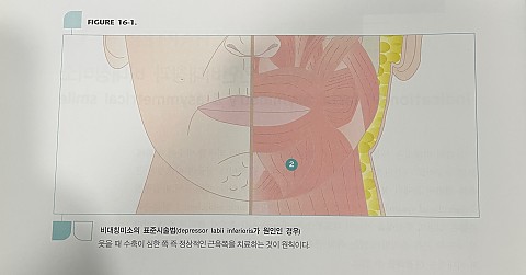 안면비대칭_ 비대칭미소 보톡스 개선방법에 대하여 