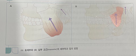 교근비대증 원인에 대해 보툴리놈독소를 이용한 사각턱보톡스 