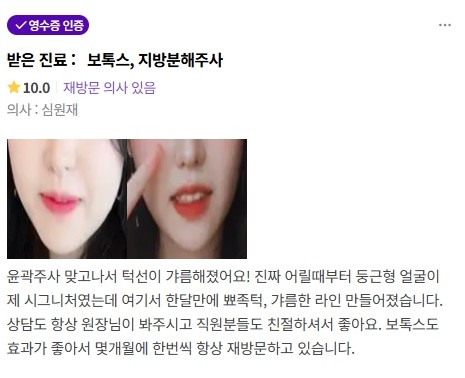 볼살주사 후기 