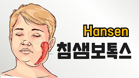 침샘보톡스 추천대상 통증 효과 부작용 주기에 대해서 알려드리겠습니다 